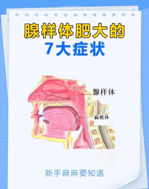 腺体:揭秘人体与动物体内的特殊物质生产者